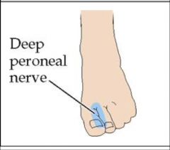 Deep peroneal nerve