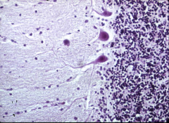 molecular layer, most superficially (few cells in it).   Granular layer most internally (LOTS of cells in it).  Purkinje cells separating the two.