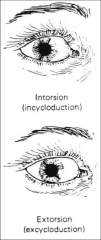 eye rotated nasally vs eye rotated laterally, along the y axis