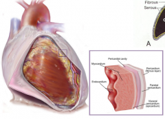 Fibrous pericardium
Serous pericardium-continuous membrane that forms two layers separated by serous-filled pericardial cavity
   Parietal pericardium-adhered to deep surface of fibrous pericardium
   Visceral pericardium (epicardium)-outer layer ...