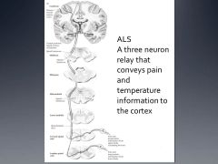 What happens if you damage ALS? How would it be different from damaging DCLM tract?