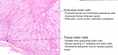 Granulosa lutein cells (formerly membrana granulosa cells); they stain pale pink w/ round nuclei and extensive cytoplasm