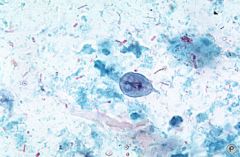 This photo is of what most common protozoan parasite found in the US?
