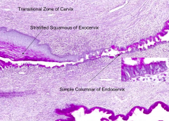 - Exocervix: stratified squamous, non-cornified (wet type)
- Endocervix: simple columnar epithelium