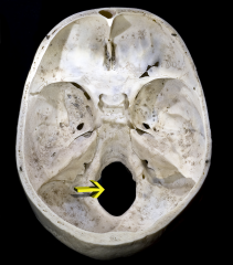 the hole in the base of the skull through which the spinal cord passes.