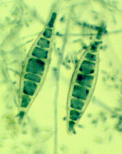 thick walled spindle shaped macroconidia