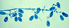 ovoid to pyriform macroconidia with 1-3 cells,
relatively thin, finely rough walls, and broad truncate bases