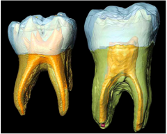 Describe the pulp of Primary teeth 