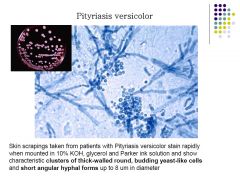 MICROSCOPY
- thick round oval cells - clusters
- short angular hyphae forms
CULTURE
- small circular colonies pinkish