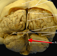 Potential space between cerebellar hemispheres