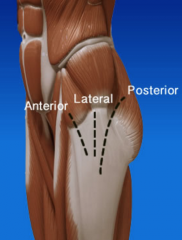 Anterior approach – Typically paediatric
Posterior approach (curved) – Typically THRLateral approach (straight) – Proximal femur #