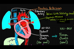   Upon birth, the foramen ovale is initially closed by the septum primum (valve of foramen ovale) as pressure in the left atrium exceeds that in the right atrium.  