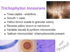 - causes tinea capitis 
- endotrhix meaning spores are in the hair follicle
- growth in 1 week
- yellow brown colony
- clavate and pyriform microconidia
- balloon microconidia chlamydoconidia present
