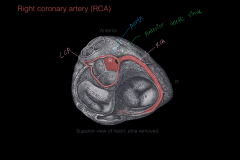 The right coronary artery 

(RCA)

arises from the anterior aortic sinus of the ascending aorta