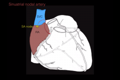 

The anterior right atrial branch gives rise to the sinoatrial nodal artery ,which supplies the SA node (the pacemaker of the heart).