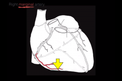 The marginal branch of the right coronary artery supplies the right ventricle.