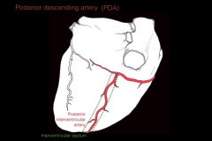   Another name for the posterior descending artery (PDA)=Posterior interventricular artery  