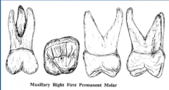 Tooth Anatomy and Eruption Sequence/dates of primary and permanent ...