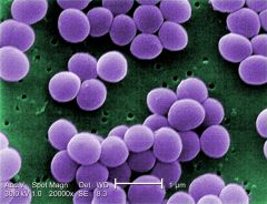 Scanning Electron Micrograph (SEM) and colonies of Staphylococcus aureus: