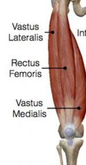 Vastus lateralis:
 O: upper lateral part of the intertrochanteric line, upper half of the lateral lip of the linea aspera     


 Vastus medialis
 O: lower medial part of the intertrochanteric line, medial lip of linea aspera 


I: tibial tuberosi...