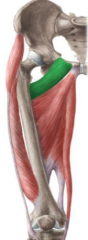 O: superior ramus of the pubis
I: pectineal line of the femur 
A: hip adduction, hip flexion, medial rotation