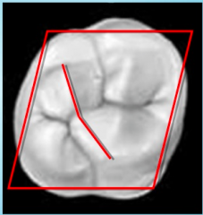 The only tooth on which an oblique ridge is found is the maxillary molar. An oblique ridge consists of a union between the triangular ridge of the distobuccal cusp and the distal cusp ridge of the mesiolingual cusp. 

*Maxillary first molar