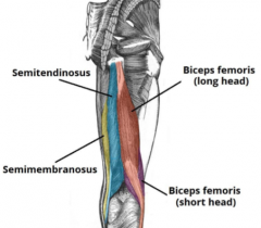 Hamstrings
-semitendinosus
-semimembranosus
-biceps femoris
