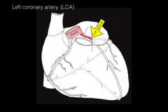 The left coronary artery arises from the left posterior aortic sinus of the ascending aorta and passes forward between the pulmonary trunk and the left auricle.