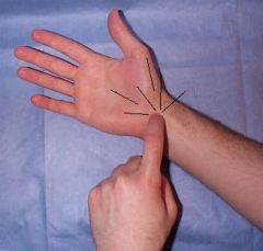 Patient Positions: Standing or seated with elbow in slight flexion


 


Examiner Position: Standing in front of the patient with stabilizing hand on distal forearm (supporting flexed position)


 


Procedure: Place index finger over middle fin...