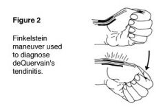 Patient Position: Seated or standing, elbow flexed to 90 or shoulder flexed to 40-60 degree


 


Examiner Position: Standing in front of patient


 


Procedure: Instruct patient to close fist around the thumb and then ulnarly deviate wrist. Cl...