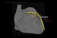 Left marginal artery=Obtuse marginal artery