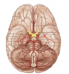 This is one of the major branches of the internal carotid a. It passes between the temporal & frontal lobes to supply the lateral surface of the cerebral hemispheres. 