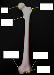 What bone is this and is it Left or Right?