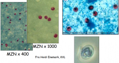 . Fæces-udstrygning og farvning 
med modificeret Ziehl-Nielsen
B. IF efter oprensning
C. Typning/artsbestemmelse ved 
DNA-teknik på oprensede 
oocyster (vigtigt ved case 
udredninger)