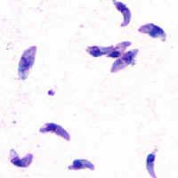 Toxaplasma er en obligat intracellulær parasit der er i familie med bl.a. coccidier.

Livscyklus for toxoplasma er meget kompleks og har bl.a. både en seksuel og en asexuel cyklus.

Den seksuelle cyklus foregår kun i dyr af katteslægten ( felidae ). D