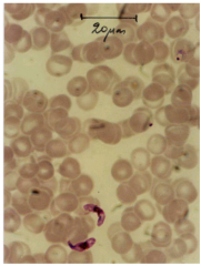 P. falciparum, årsag til falciparum malaria, malign 3. dags feber. (på billedet)
P. vivax, årsag til vivax malaria, benign 3. dags feber. 
P. ovale, årsag til ovale malaria, benign 3. dags feber. 
P. malariae, årsag til malariae malaria, 4. dags feber.