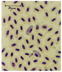 Mikroskopi af Giemsafarvet blodudstrygning.
(på billedet leucocytozoon simondi) ses hos svømmefugle.