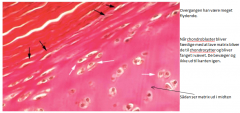 umodne bruskceller  
• Ligger i/ved perichondrium (bruskhinden) og er mere ”fladmaste”
• Ses primært i voksende brusk
• Producerer den ekstracellulære matrix, som udgør størstedelen af bruskvævet