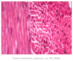 Den glatte muskulatur indeholder celler med central beliggende langstrakt kerne
•	spolformede celler
