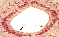 o Kubiske eller cylindriske celler
o Beklæder hulrum i CNS (i hjernen og rygmarven)