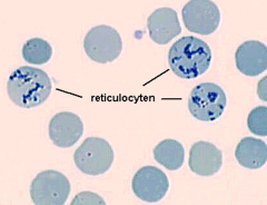 Det er stadiet mellem mellem oxyfile erythroblaster og erythrocyter. Cellen har ingen kerne, men stadig mRNA