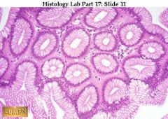 What kind of epithelium are we looking at and how do you know?