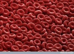 Example: Hemoglobin
Details: transports oxygen to different tissues
Shape: Globular