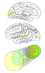 Dorsal nuclear group
-> visual cortex, auditory cortex, language processing