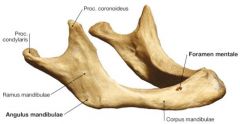 Mandibula of an old person. Loss of teeth leads to atrophy of the pars alveolaris (Foramen mentale can end up exposed on the top ridge).