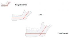 Angle between the Corpus mandibulae and the Ramus mandibulae. 

Newborns: ~140*
Dentition: decreases to ~120*
Old age: increases due to loss of teeth