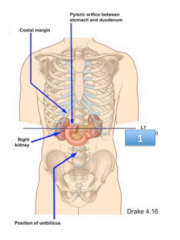 what is #1? 
what vertebral level is it?
what structures does it intersect?