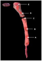Identify the sternal facet at which the cartilage of rib 3 articulates with the sternum (sternum shown in right lateral view).