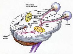 Vraag 3

Hoe is het te verklaren, dat alle visuele informatie uit het linker gezichtsveld terechtkomt in de visuele cortex in de rechter hemisfeer?