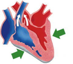 Ventricular contraction, when the ventricles push blood out into the pulmonary and systemic circulation